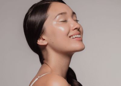 Microneedling