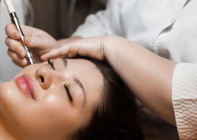 Micro-Needling